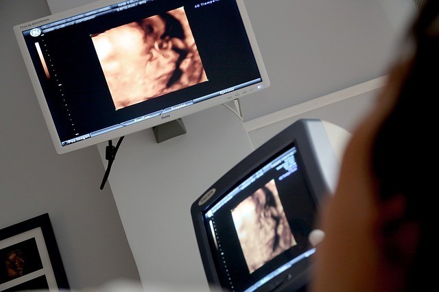 Non-invasive prenatal tests